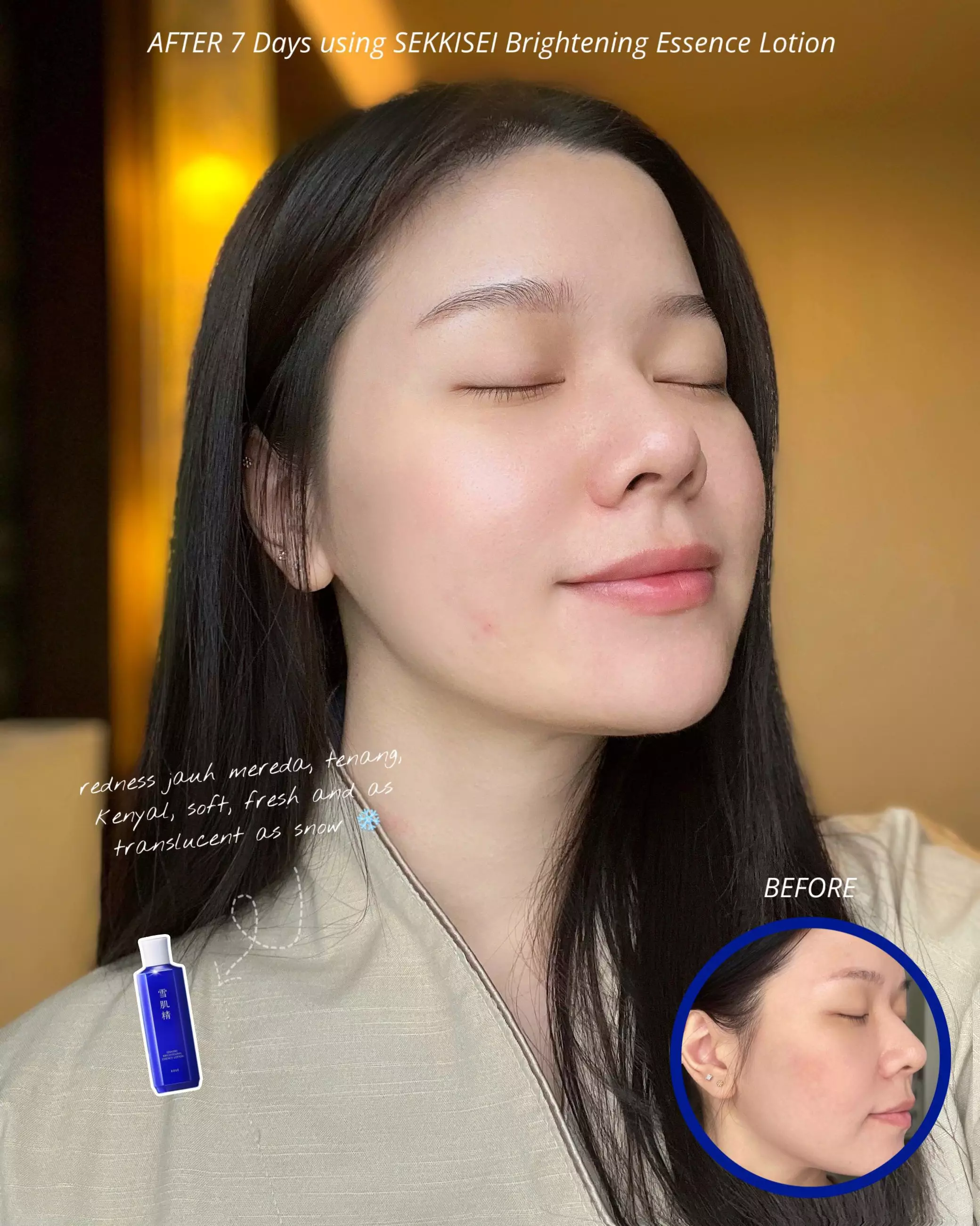 KOSE Sekkisei Brightening Essence Lotion - 350ml