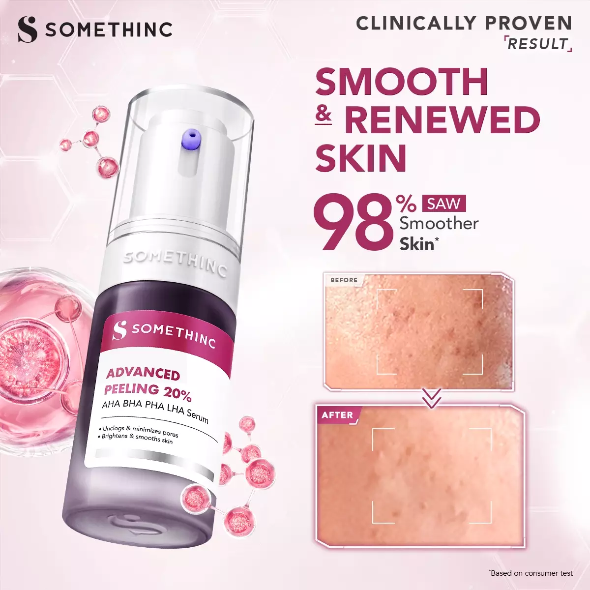SOMETHINC Advanced Peeling 20% AHA BHA PHA LHA Serum 20ml
