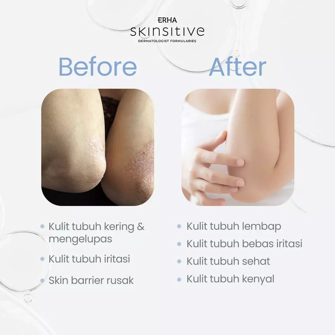 ERHA Skinsitive Ultracalm Body Lotion 125g | Pelembap Kulit Semua Jenis Kulit (Normal, Kering, Sensitif) | Gentle, No Fragrance, No Alcohol | Kulit Sangat Kering, Eksim, Ibu Hamil Menyusui, Anak Usia 3 | Skin Barrier Kuat dengan Ceramide, Calming Agent