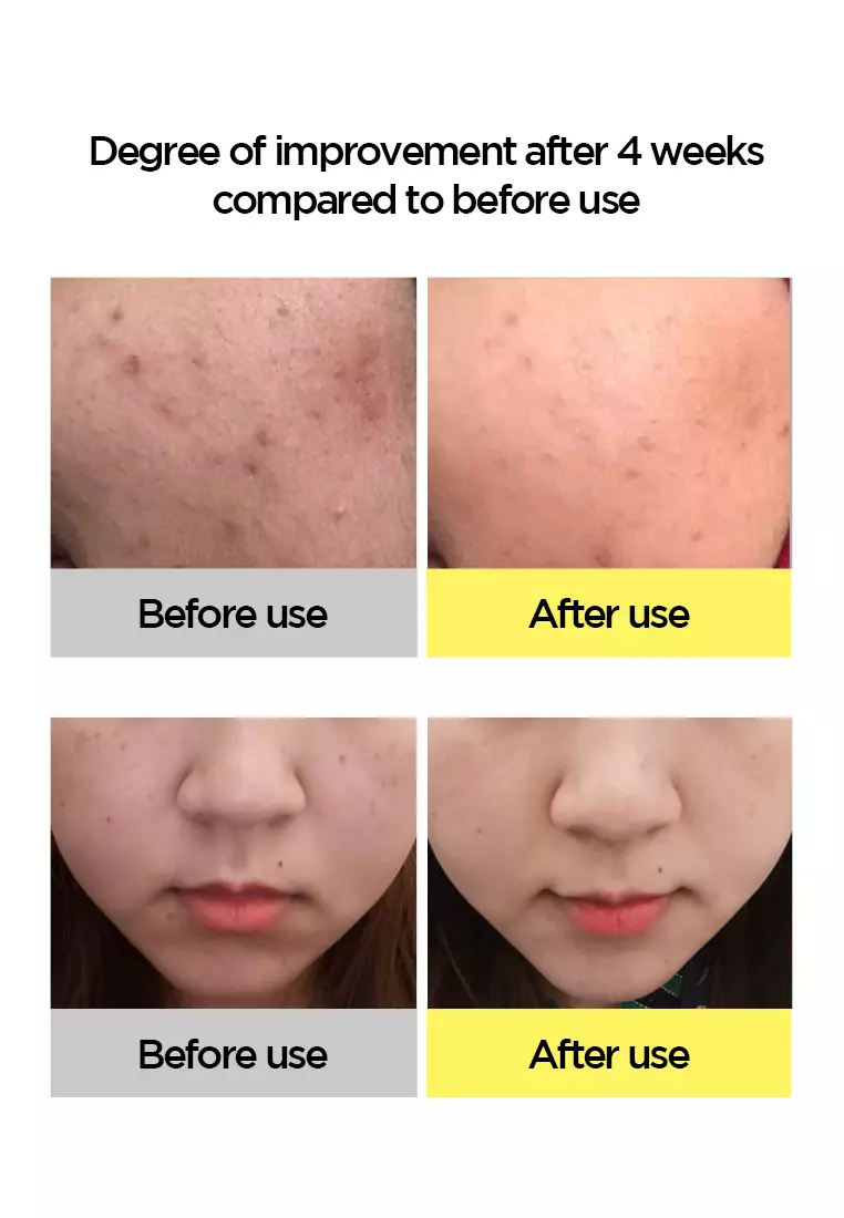 Holika Holika Gold Kiwi Vita C+ Brightening Serum