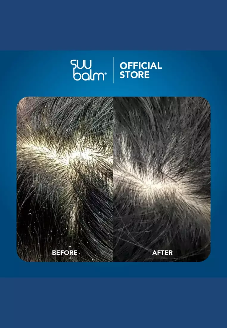 Gentle Moisturising Anti-Dandruff Shampoo 480ml