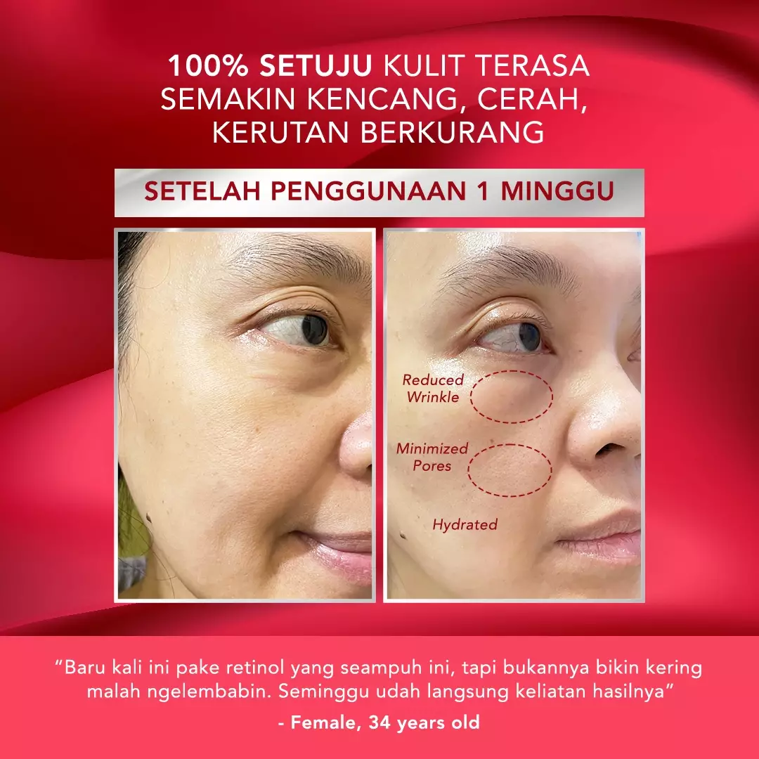 ERHA Age Corrector 1% Pure Retinol Night Charge Booster HYDRATING PURE RETINOL | Booster Awet Muda | Jojoba Oil | Phytosqualane | Melembabkan | Mengurangi Kerutan Garis Halus Keriput | Mencerahkan | Kencang Cerah Plumpy Glowing