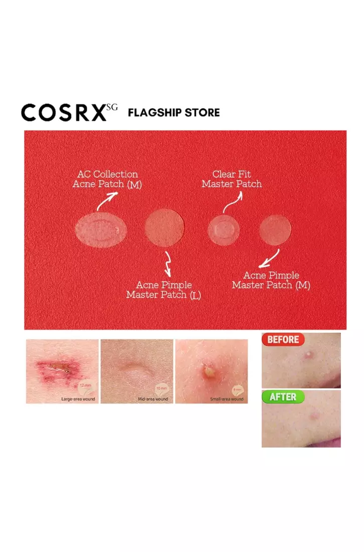 Cosrx Master Patch Intensive 36 Patches x10