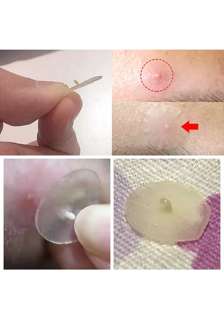 BREYLEE Sticker Jerawat Day 0.1mm (22 Stiker)