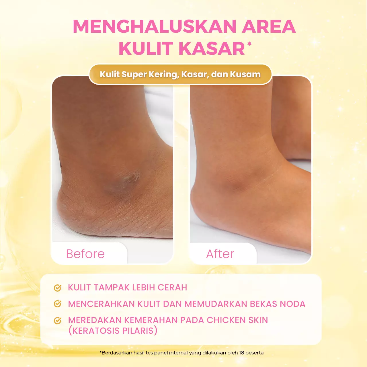 Scarlett Whitening Intense Brightening AHA Body Serum 5% AHA BHA PHA