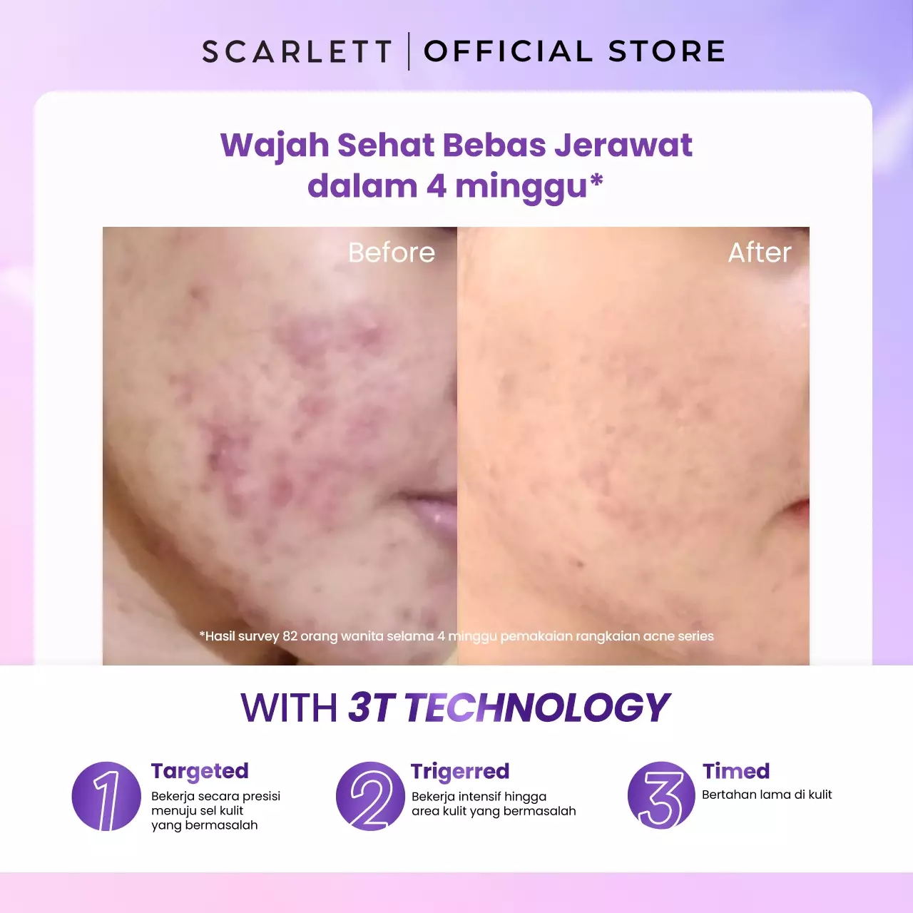 Scarlett Whitening Acne Serum