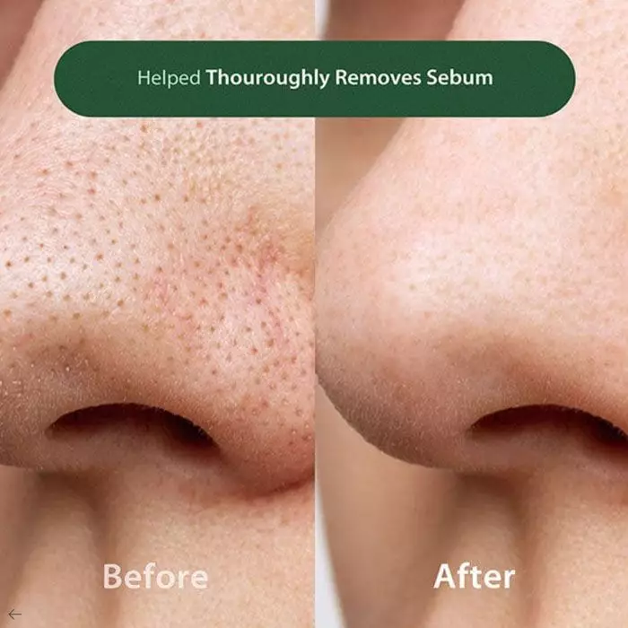 Blithe Anti-Polluaging Pore Cleansing Foam BHA 0.5 150 ml