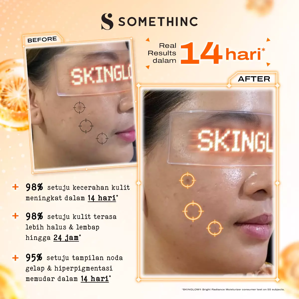 SOMETHINC SKINGLOW® Bright Radiance Moisturizer - 25ml