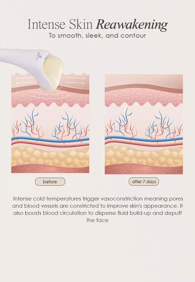 The Ice Roller | Cryotherapy Treatment