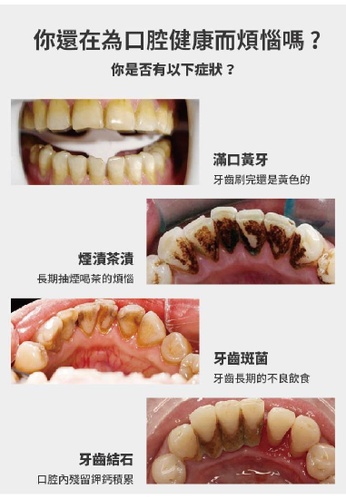 網上選購maxcare Maxcare 離子超聲波洗牙器21系列 Zalora香港
