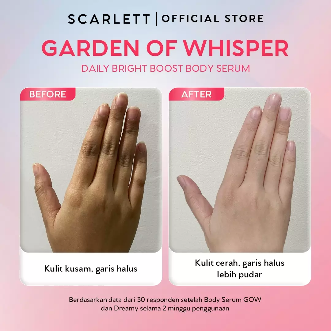 Jual Scarlett [NEW LAUNCH] SCARLETT GL…