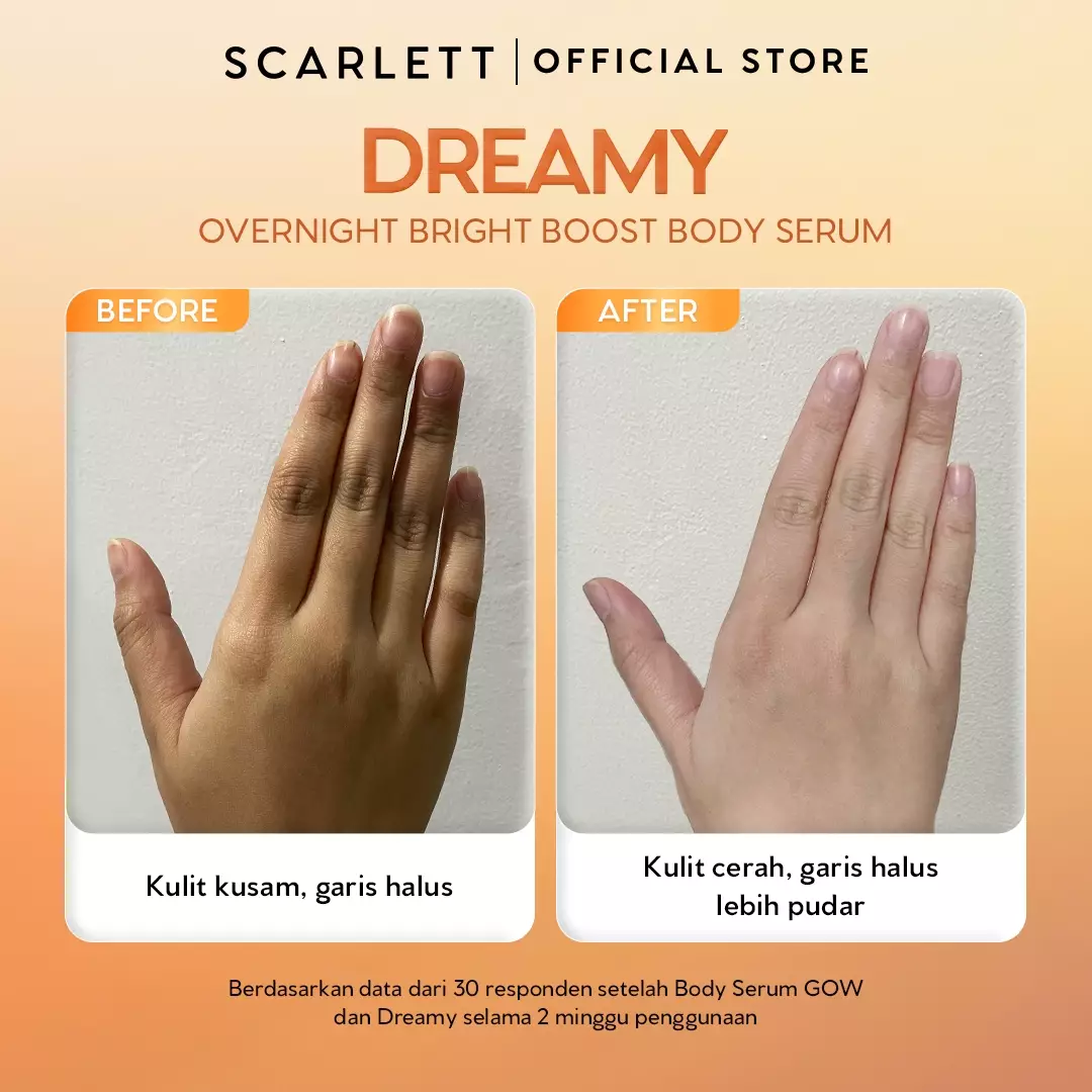 [NEW LAUNCH] SCARLETT GLUCINAMIDE Fragrance Brightening Body Serum Dreamy 170ml