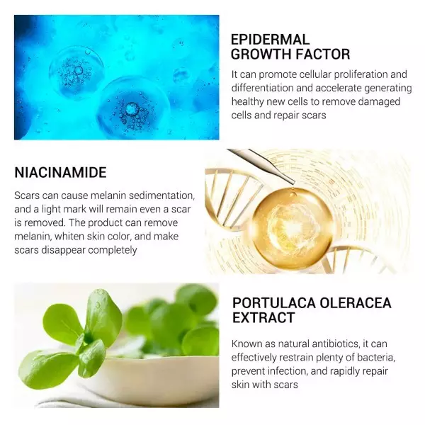 BREYLEE Krim Penghilang Noda Bekas Jerawat, Luka & Stretch Mark (30g)