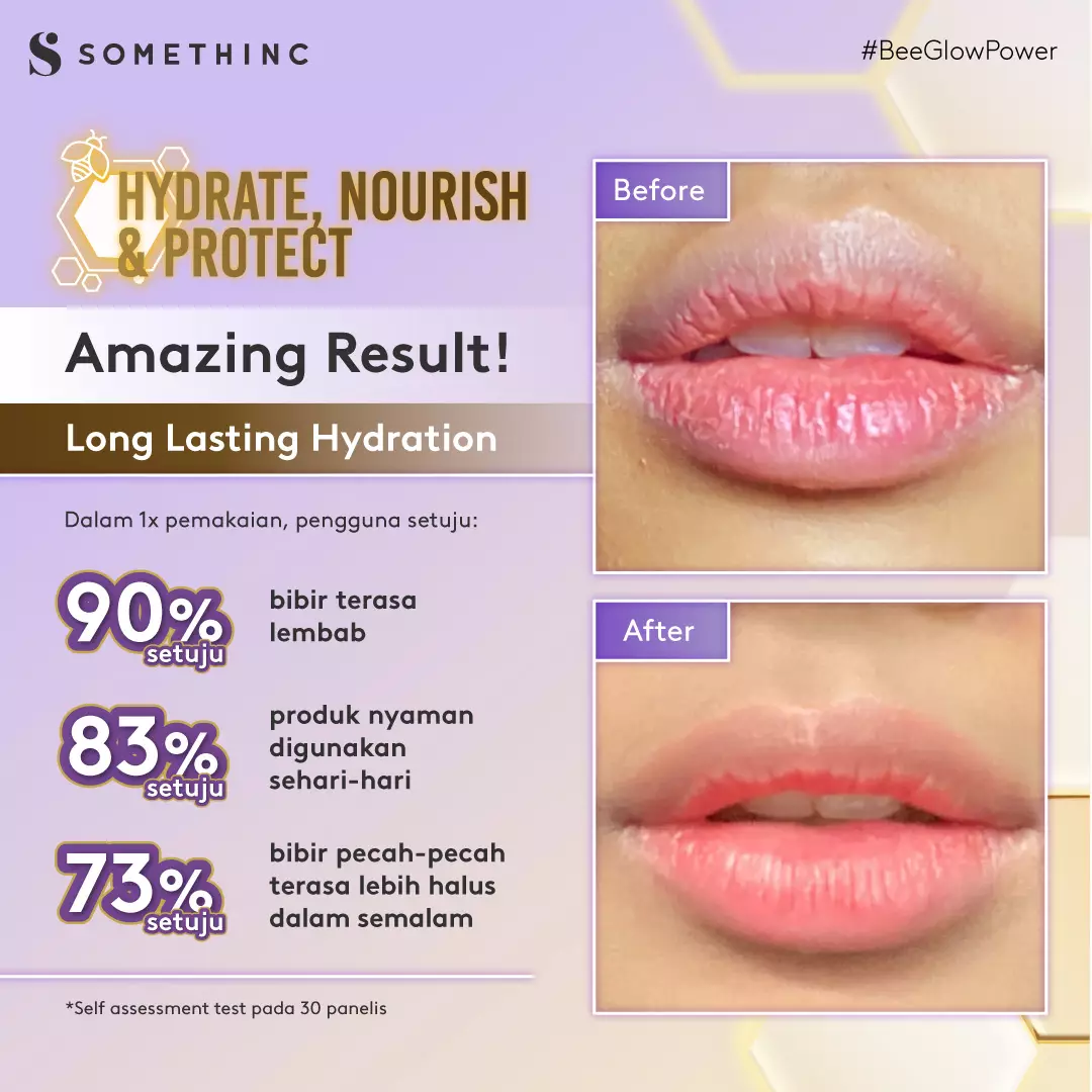 SOMETHINC Bee Power Propolis Glow Lip Serum