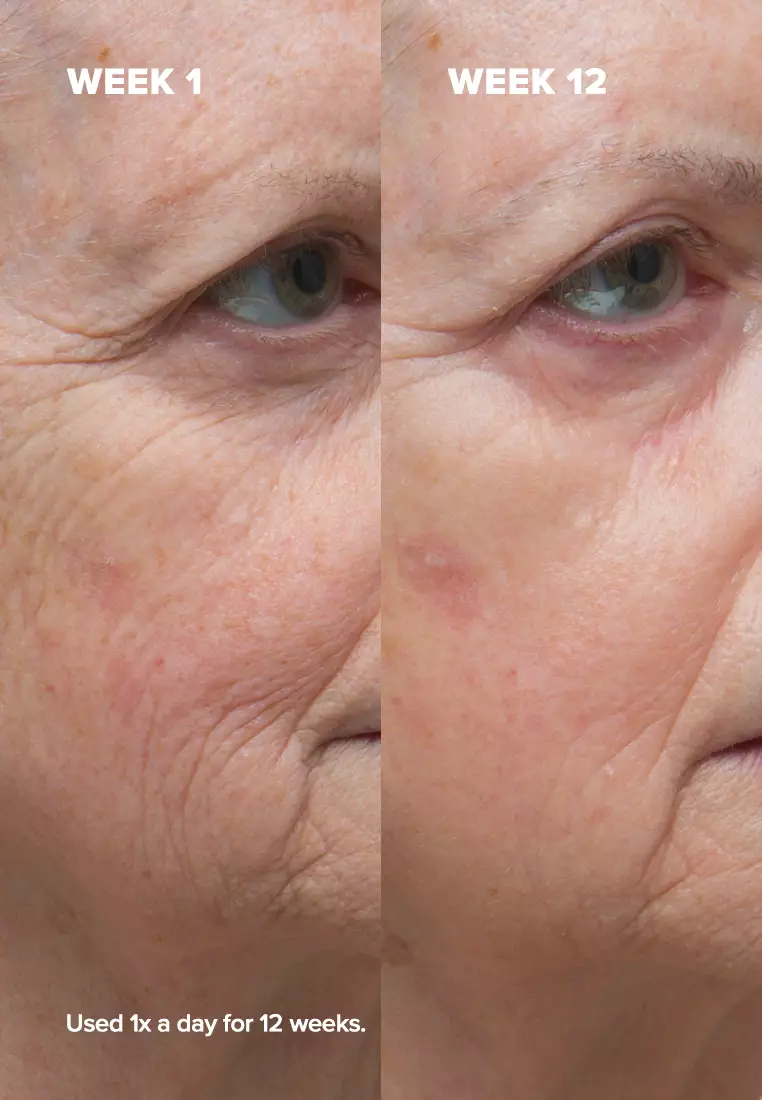 Clinical 1% Retinol Treatment 30 ml