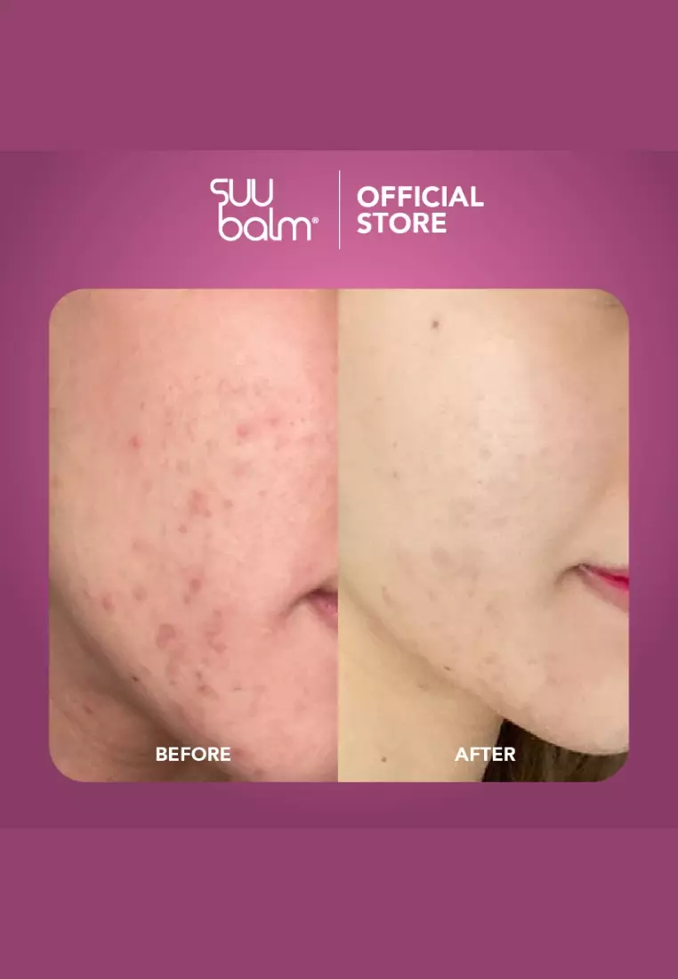 Cooling Itch Relief Facial Moisturiser