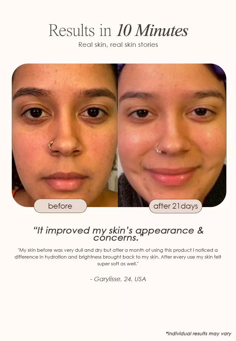 Project E Beauty Sensa 纳米离子面部蒸汽机