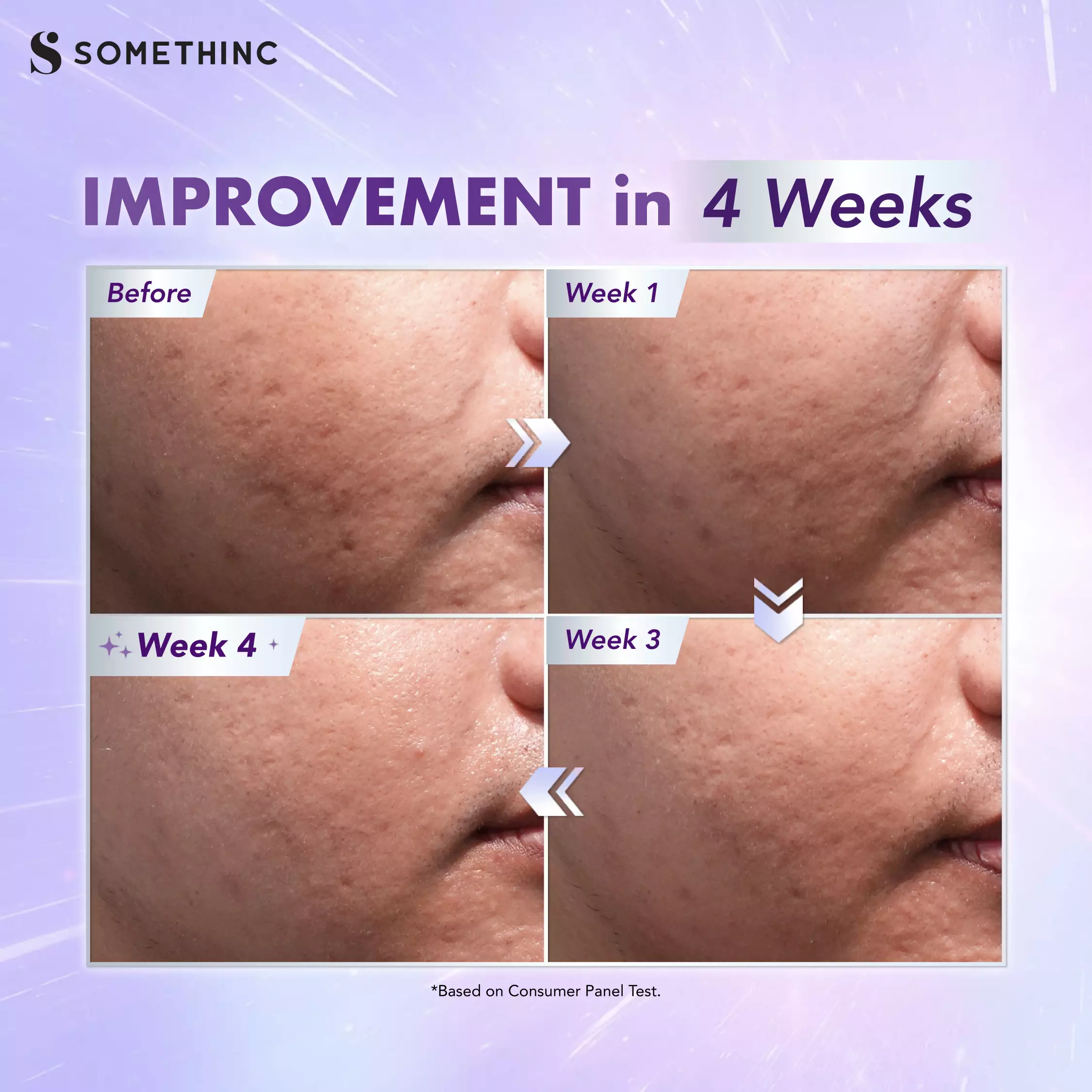 SOMETHINC BioSpicule Renewal Serum - Mild