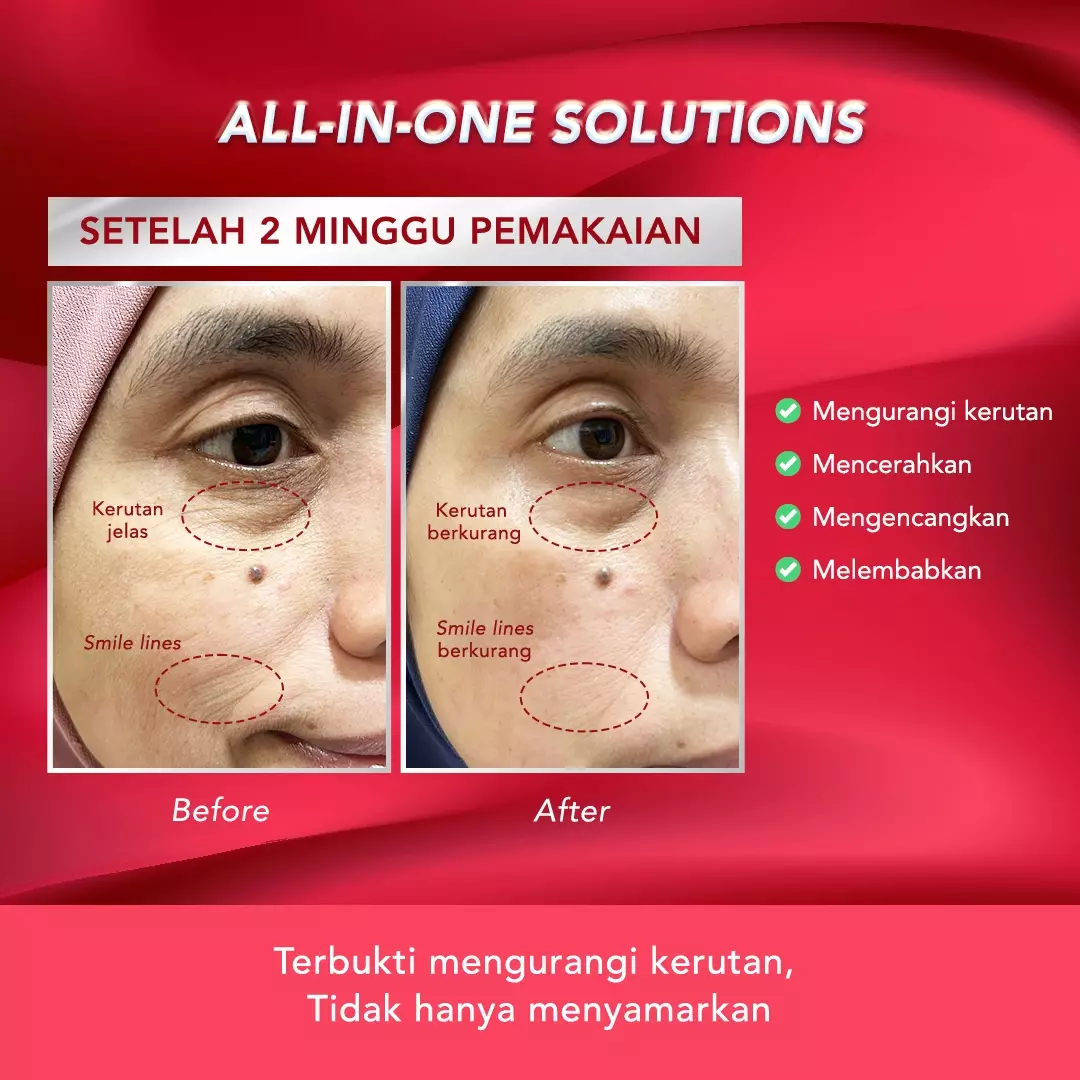 ERHA Age Corrector Serum Peptides & Soya Phytoplacenta for Well-Aging | Mengurangi Garis Halus Kerutan | Melembabkan | Boost Kolagen | Mencerahkan Flek Hitam | Glowing Plumpy | Anti Aging | Kenyal Kencang Cerah