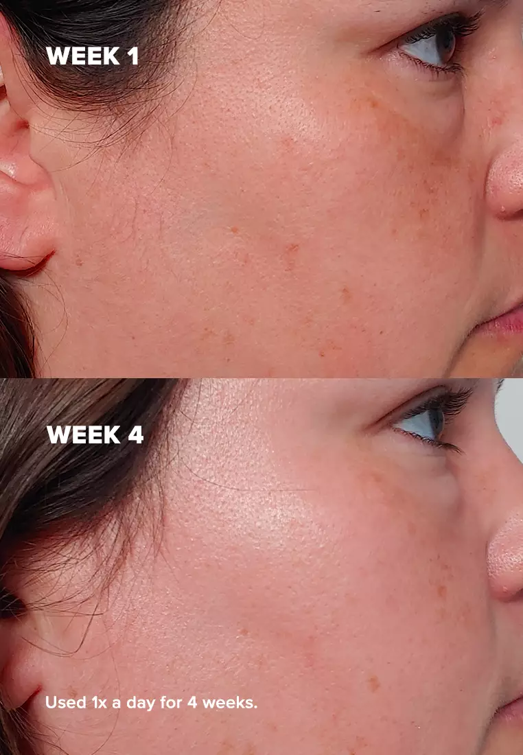Skin Perfecting 2% BHA (Salicylic Acid) Liquid Jumbo Size 236 ml