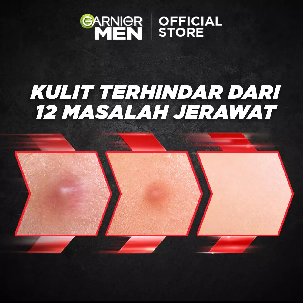 Garnier Men Acno Fight Acne Fighting Brightening Serum Cream 40ml