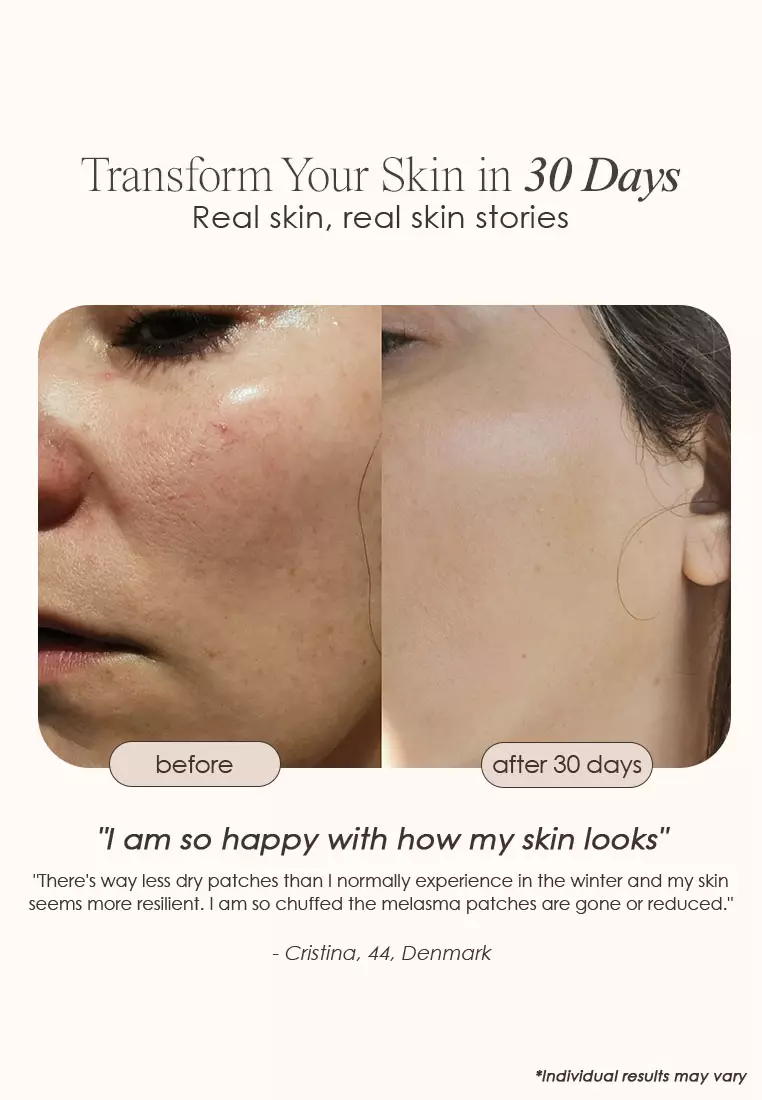 Lumamask 7 | LED Light Therapy Face Mask