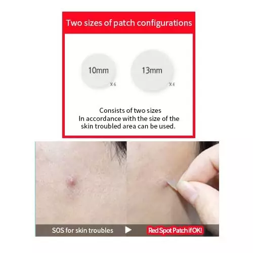 Holika Holika AC Mild Red Spot Patch