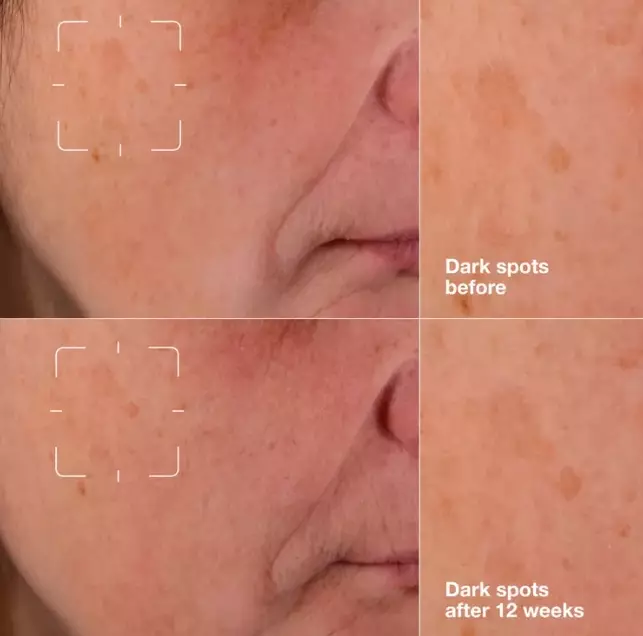 CLINIQUE Even Better Clinical™ Dark Spot Clearing Serum (30mL)