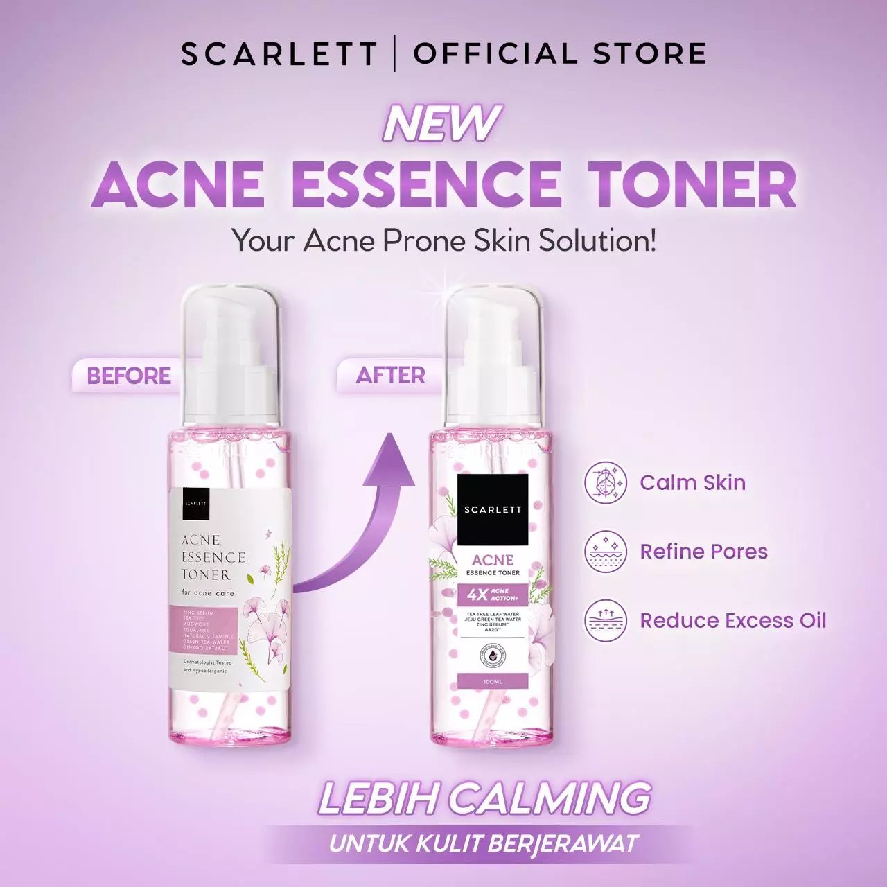 Scarlett Whitening Acne Essence Toner