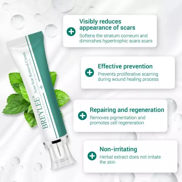 BREYLEE Krim Penghilang Noda Bekas Jerawat, Luka & Stretch Mark (30g)