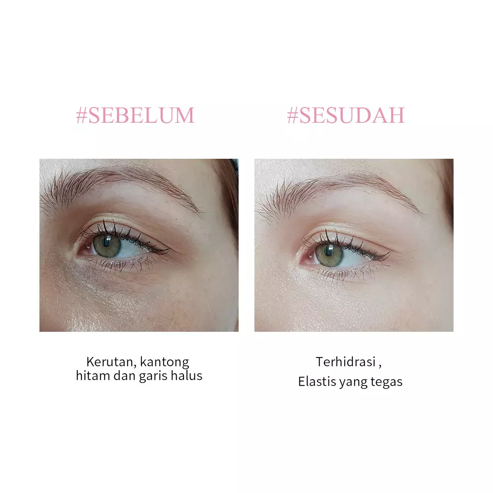 BREYLEE Rose Eye Mask - Masker mata Refreshing, Menyegarkan, Melembabkan, Area Sekitar Mata (60 pads)