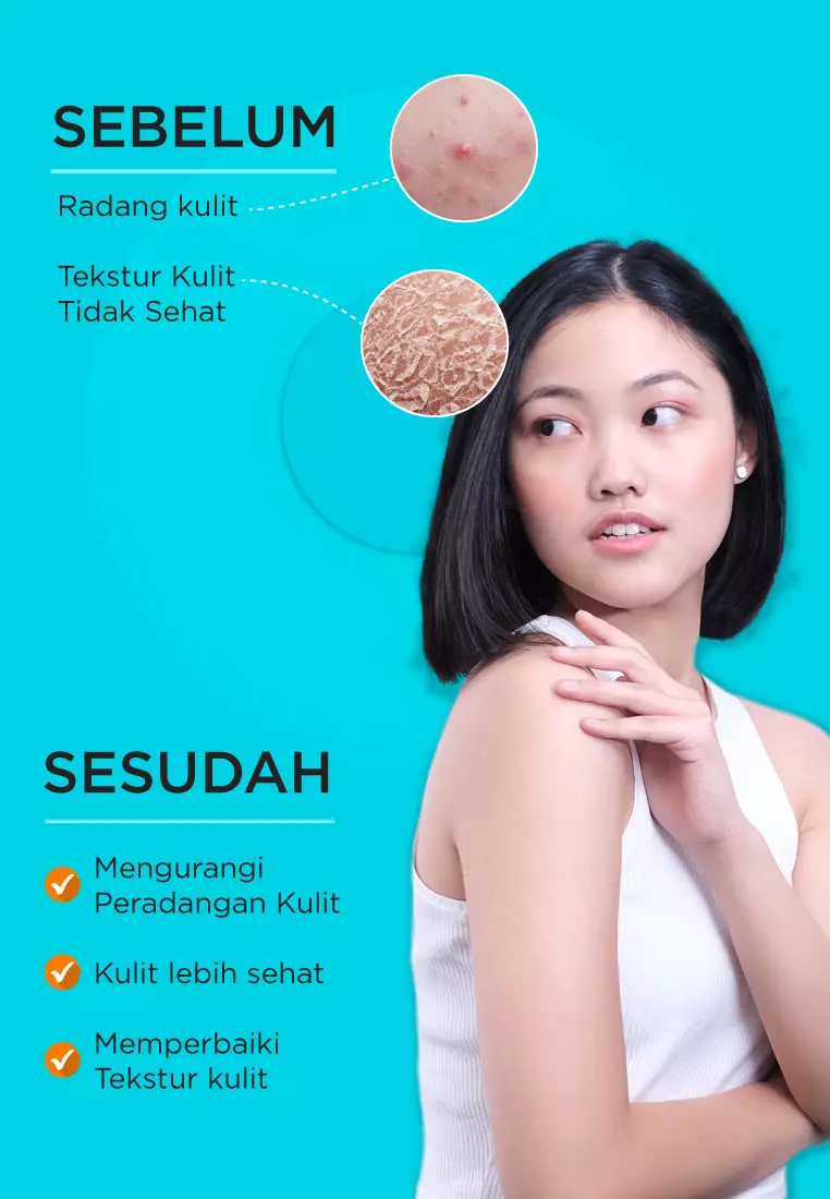 ERHA Zincore 30Caps - Suplemen Kulit Jerawat