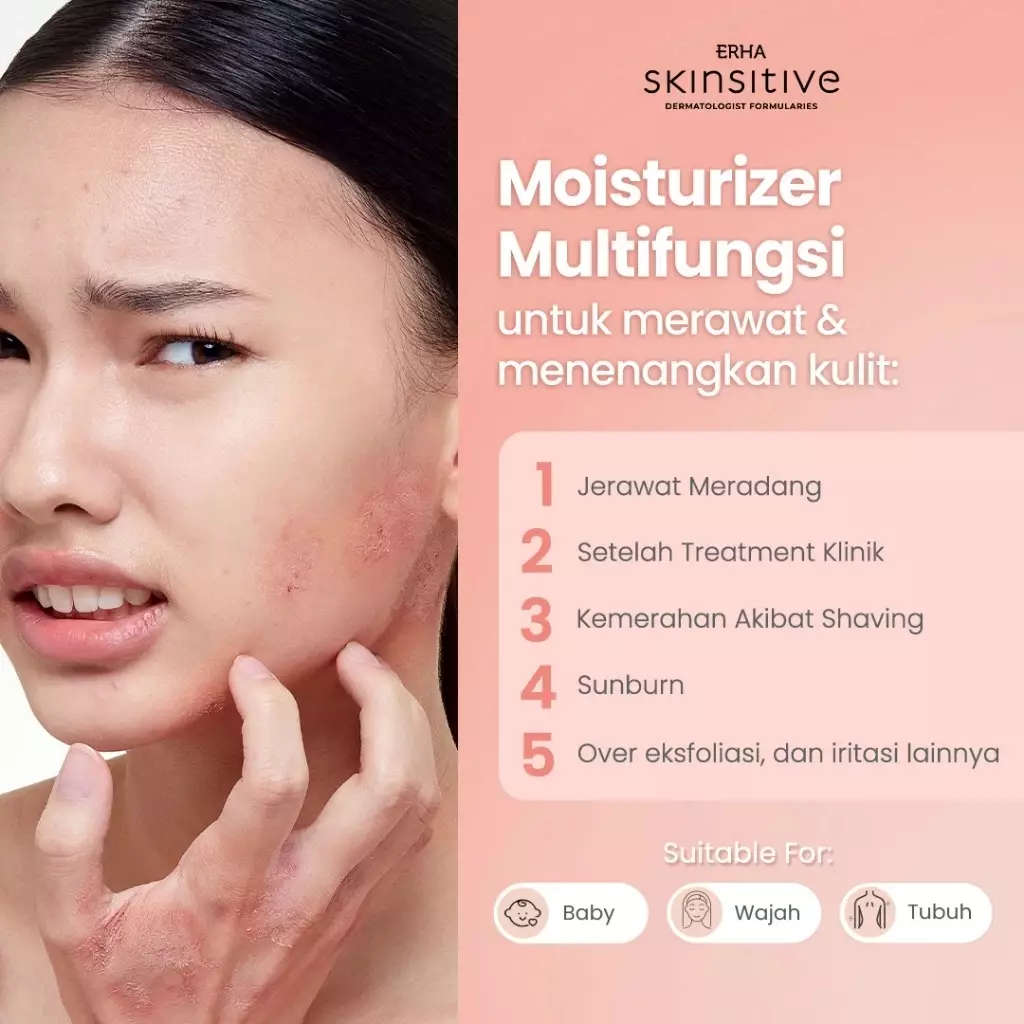 ERHA Skinsitive UltracalmPRO Multipurpose Calming Cream 100gr | Krim Multifungsi Untuk Semua Jenis Kulit (Normal, Kering, Sensitif, Iritasi) | Meredakan Gatal dan Kemerahan, Sunburn | Meredakan Eksim | Mencegah Stretchmark | Aman untuk Anak 3+