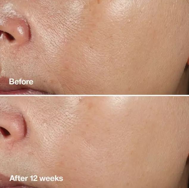 CLINIQUE Smart Clinical Repair Wrinkle Correcting Serum • 30ml 