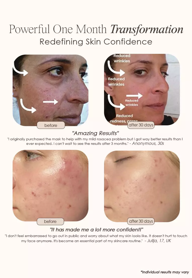 Buy Project E Beauty LightAura LED Face Mask 2024 Online ZALORA