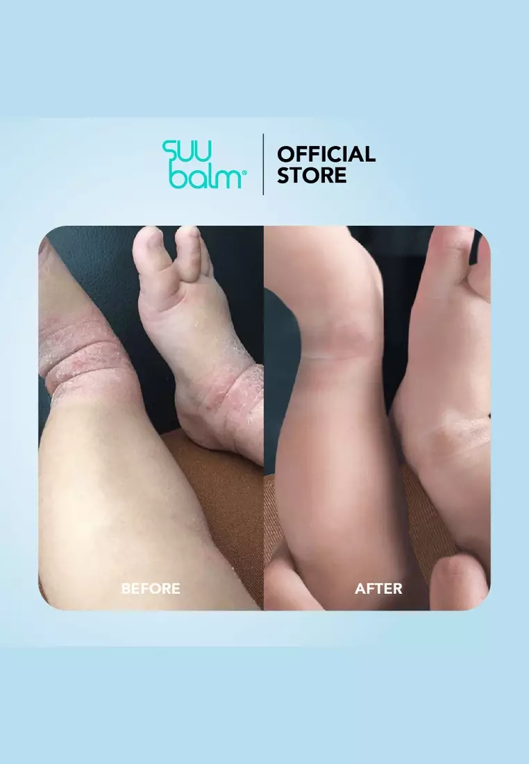 Kids Ceramide Moisturiser Gentle Itch Relief Cream 75ml