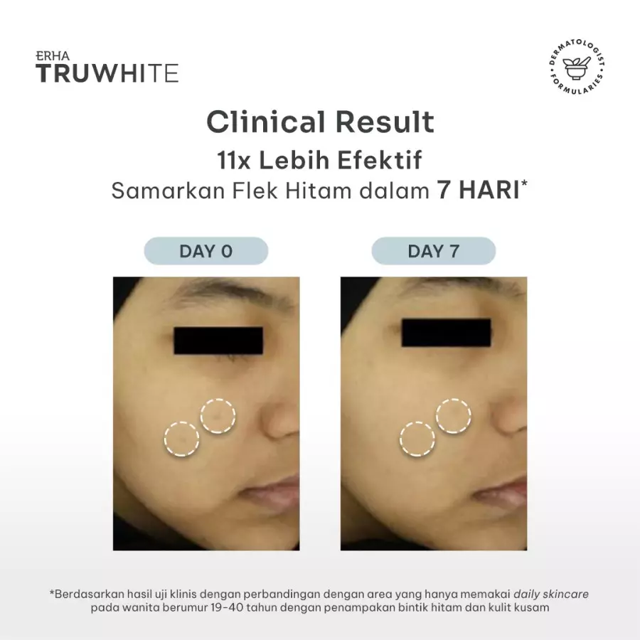 ERHA Truwhite Niacinamide & Peptide Dark Spot Corrector