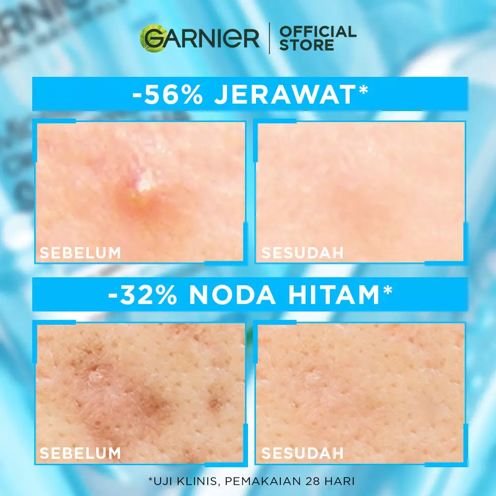 Garnier Micellar Water Salicylic Blue 400ml Pack of 3