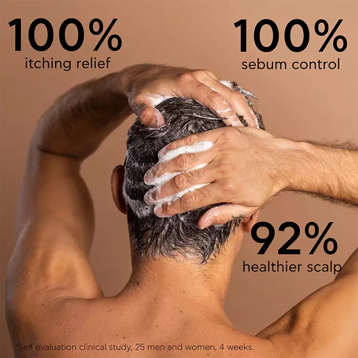 Apivita Oily Dandruff Shampoo 250 ml | Sampo Natural Non SLS Anti Ketombe untuk Rambut Kulit Kepala Berminyak Untuk Rambut Lembut