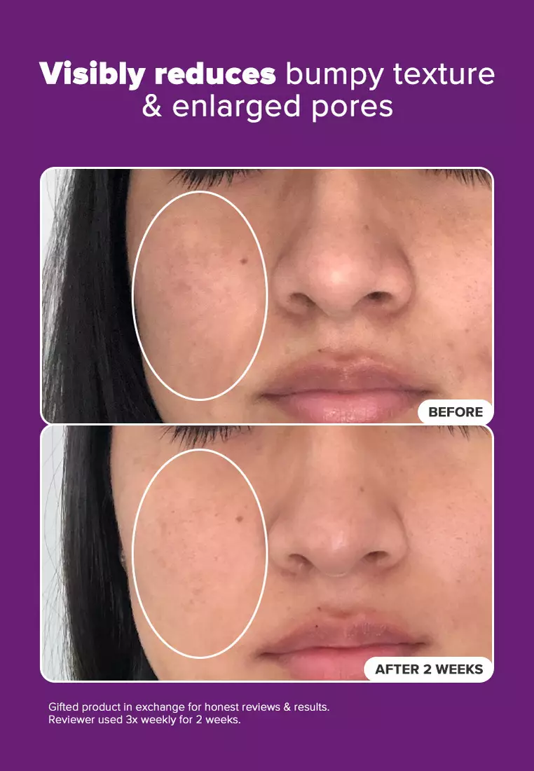 Clinical Niacinamide 20% Treatment 20 ml