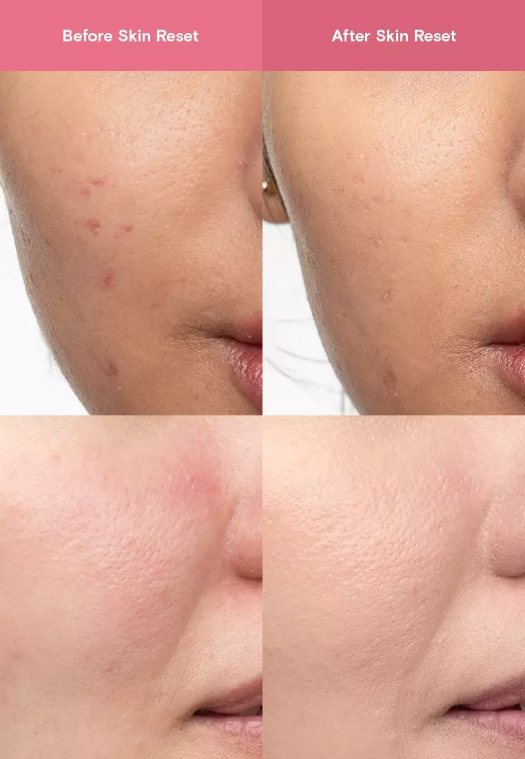 skin reset hypochlorous acid facial spray