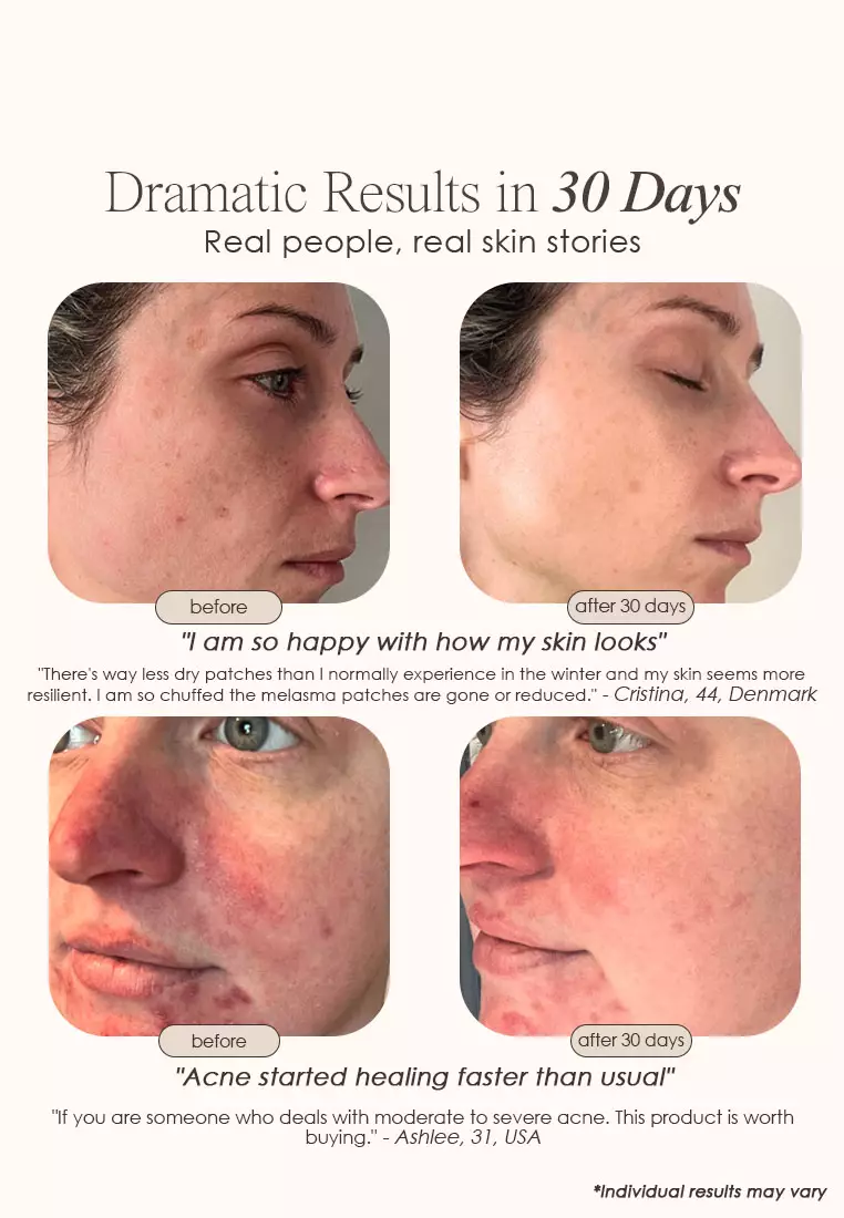 Buy Project E Beauty LightAura Plus LED Face & Neck Mask 2024 Online