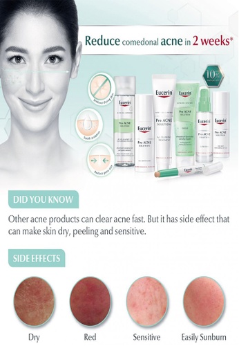 Buy Eucerin Eucerin Pro Acne Solution Cleansing Gel 200ml Online Zalora Malaysia