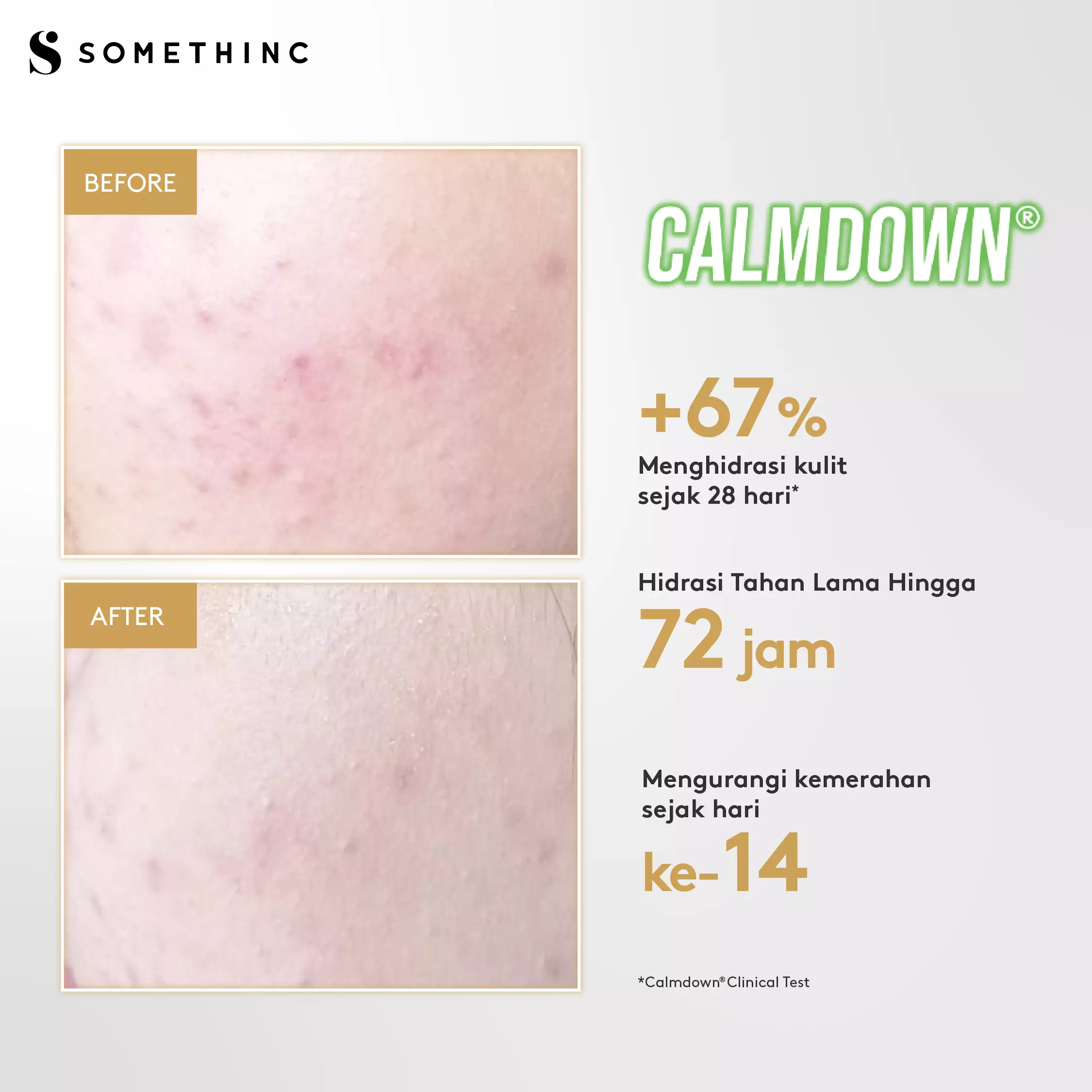 [Tasya Farasya Approved] SOMETHINC Calm Down! Skinpair Moisturizer - 50ml
