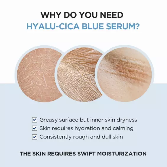 SKIN1004 Madagascar Centella Hyalu-Cica Blue Serum (50ml)