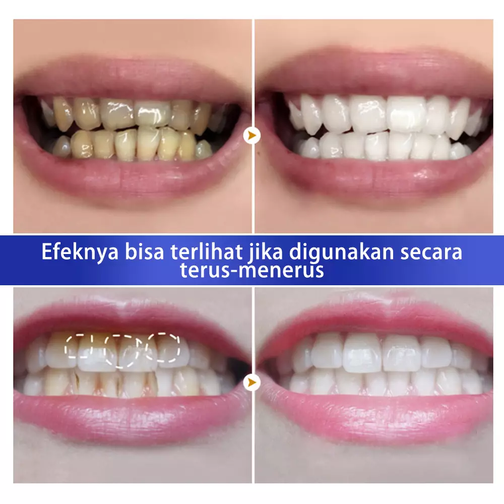 [BPOM] Breylee Teeth Whitening Powder - Mencerahkan Gigi (55 gr)