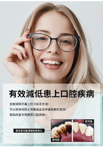 網上選購maxcare Maxcare 離子超聲波洗牙器21系列 Zalora香港