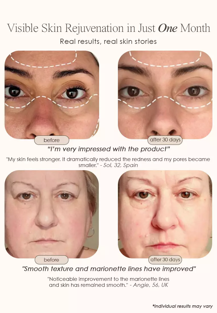 Lumamask Pro | LED Light Therapy Face Mask