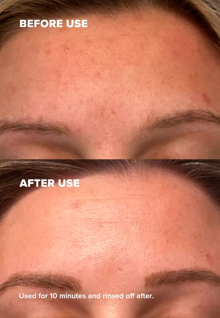 Skin Perfecting 25% AHA + 2% BHA Exfoliant Peel 30 ml